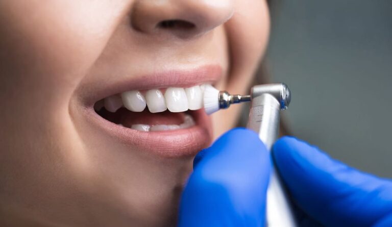 Професійна чистка зубів у H&B Clinic: ідеальна посмішка в Києві
