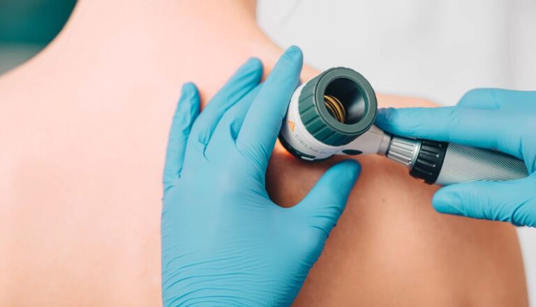 Червоний плоский ліхен шкіри: коли варто звернутися до дерматолога